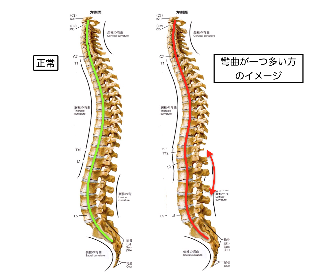 背骨の彎曲が一つ多い方のイメージ